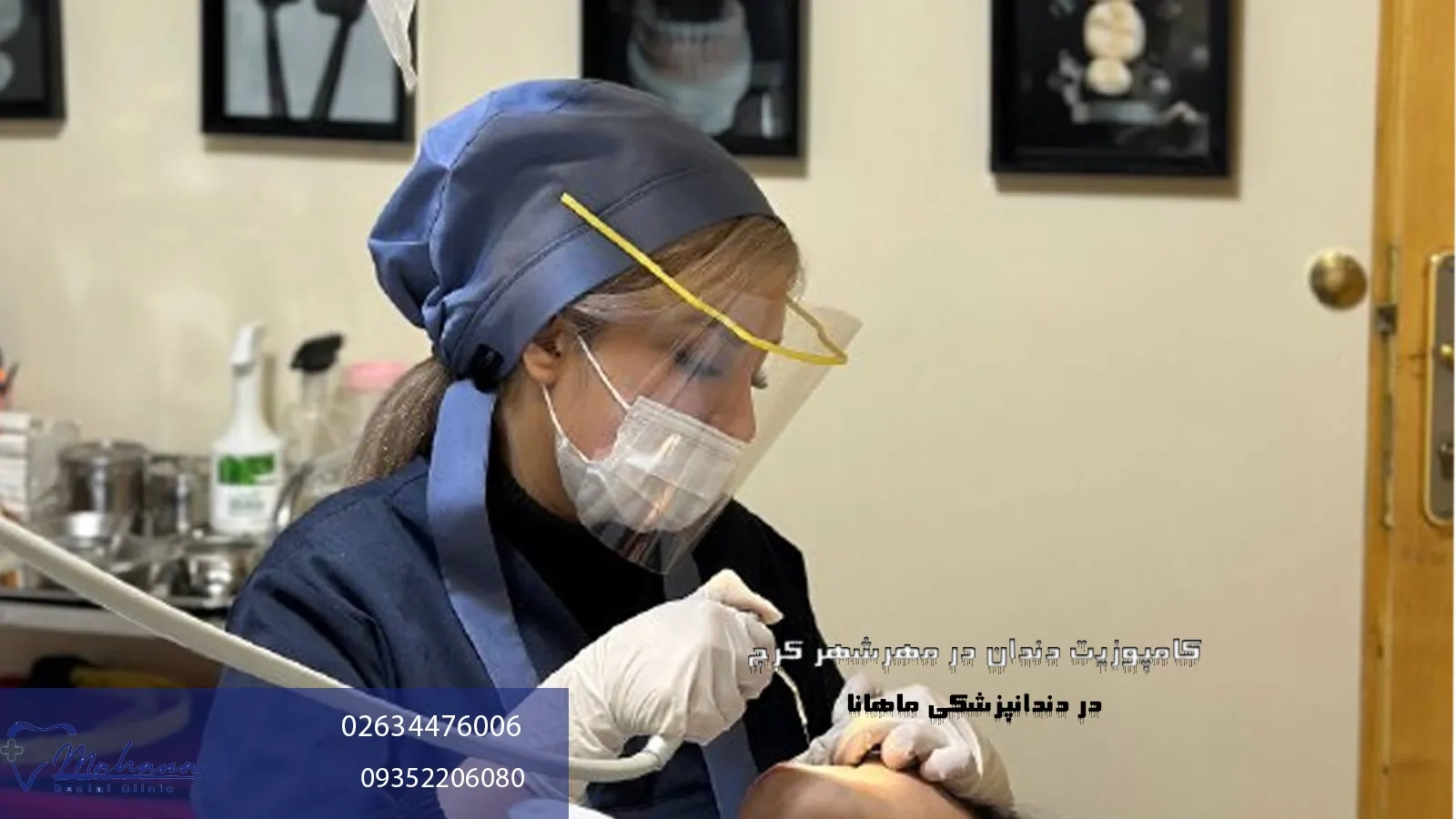 متخصص کامپوزیت دندان در مهرشهر کرج