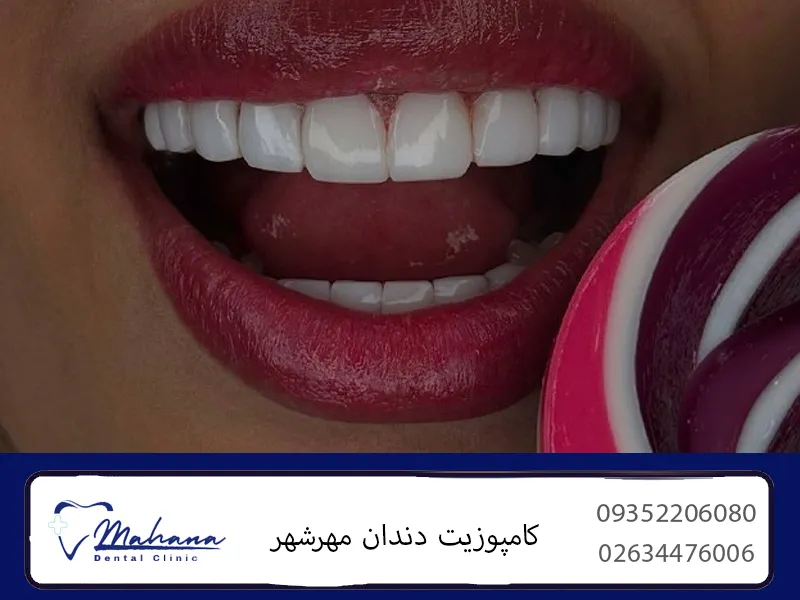 کامپوزیت دندان در مهرشهر