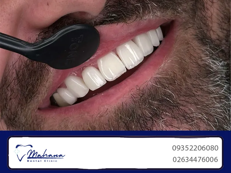 دندانپزشکی زیبایی در حصارک کرج 