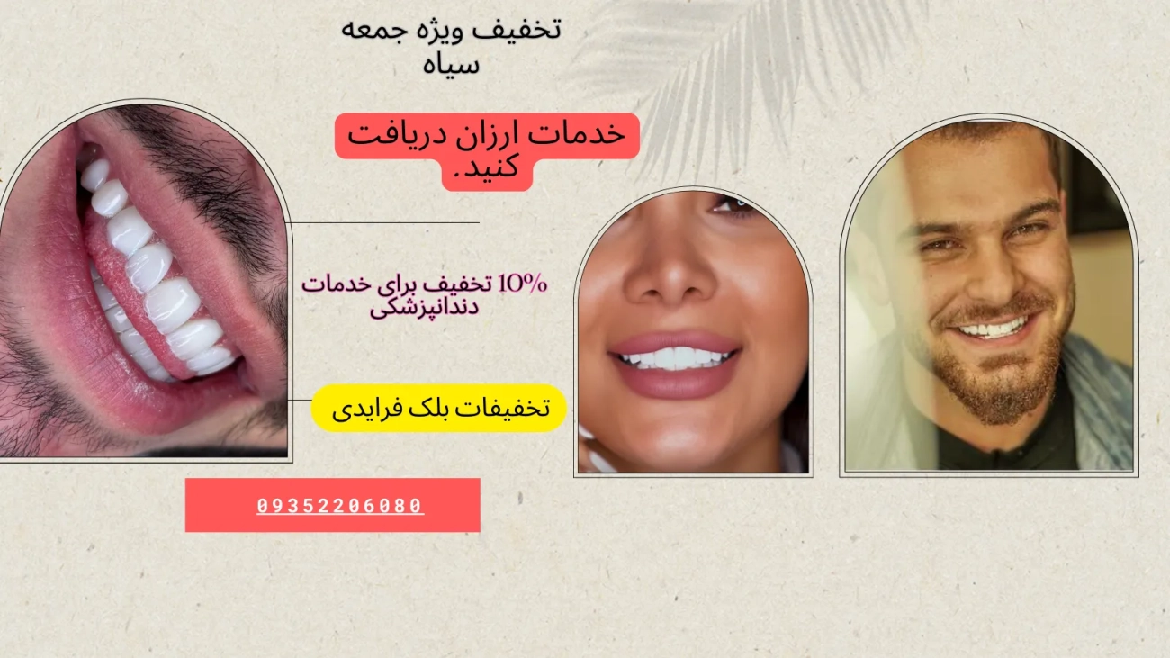 تخفیفات دندانپزشکی در بلک فرایدی