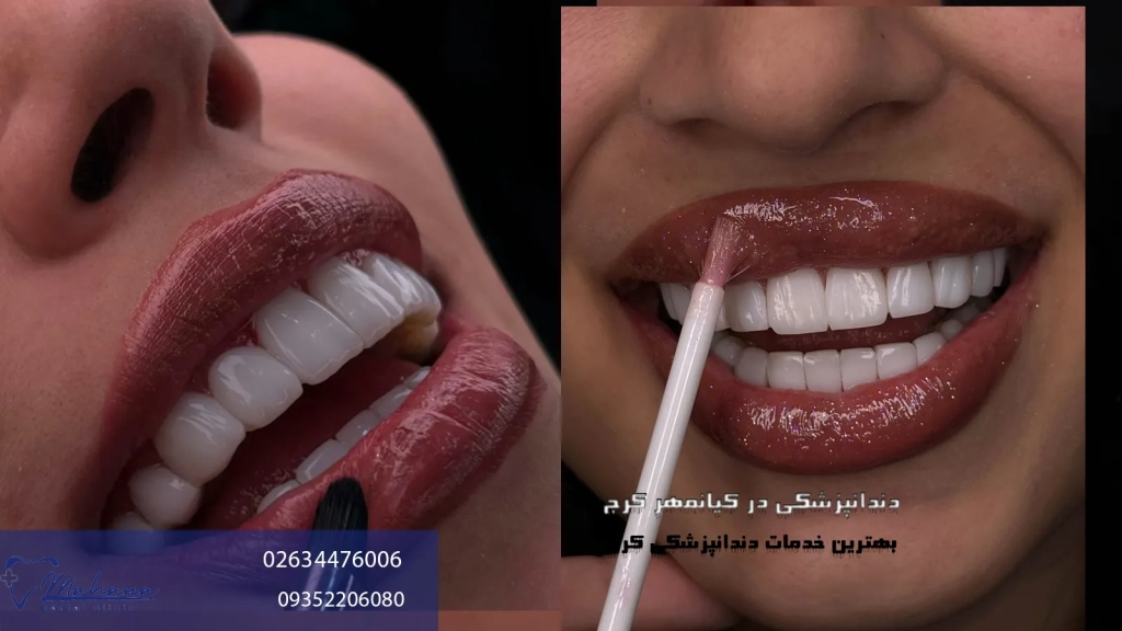 دندانپزشکی در کیانمهر کرج