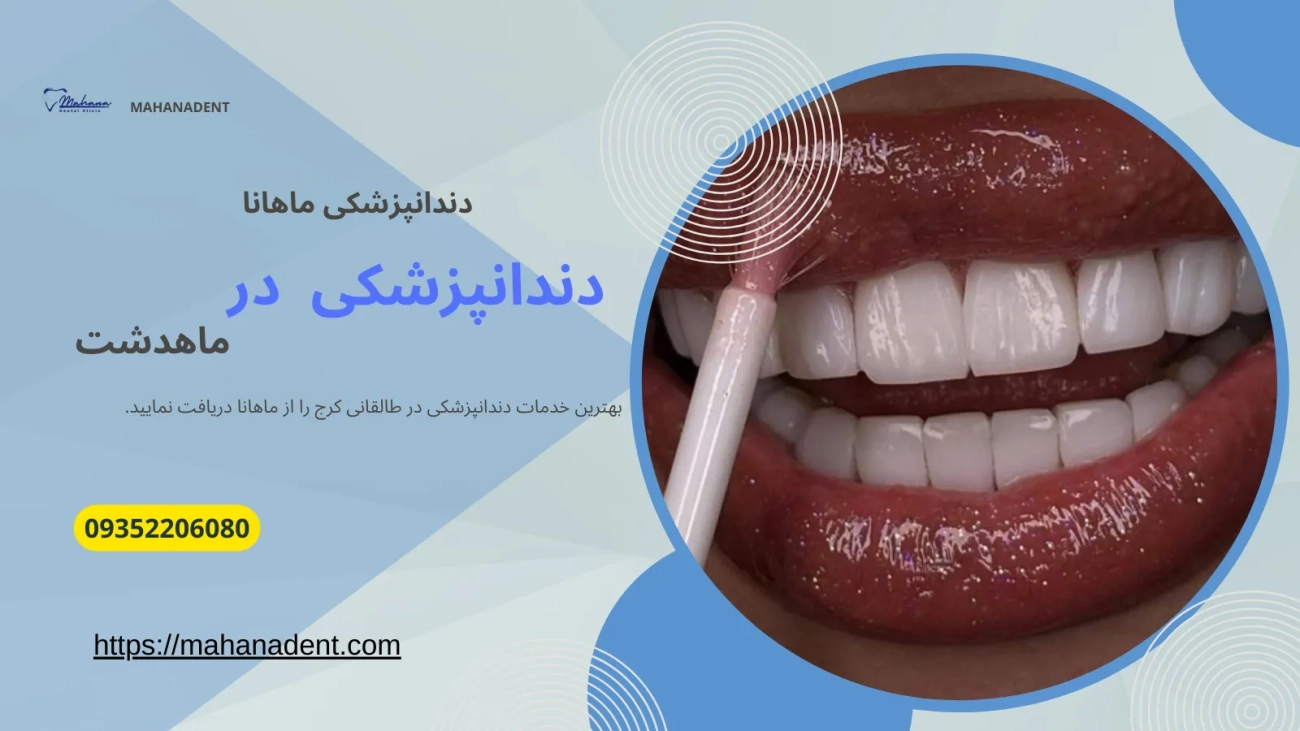 دندانپزشکی در ماهدشت کرج