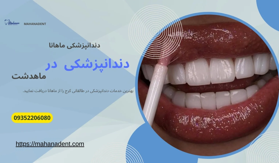 دندانپزشکی در ماهدشت کرج