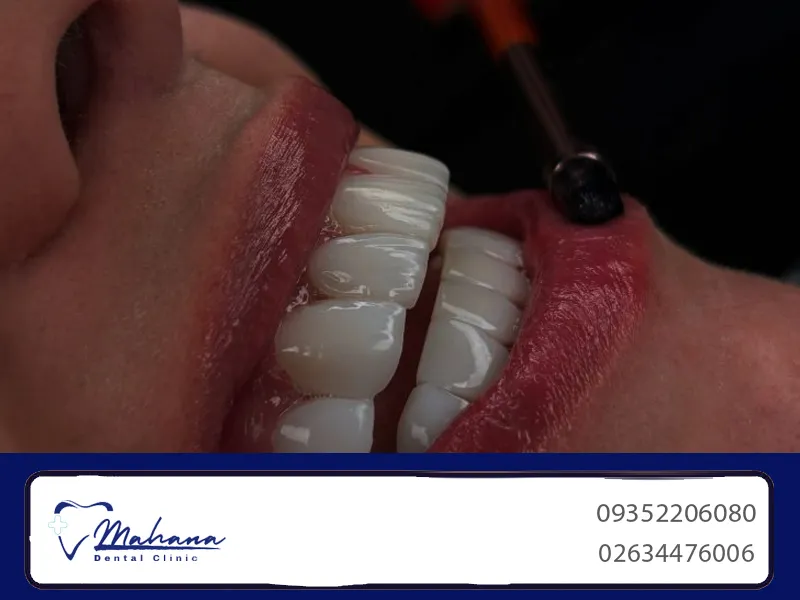 دندانپزشکی در گوهردشت کرج