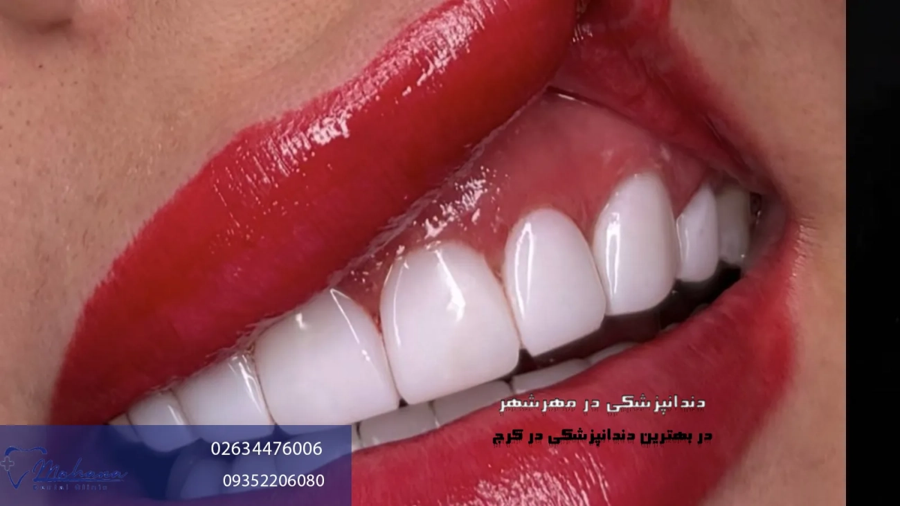 دندانپزشکی در مهرشهر کرج