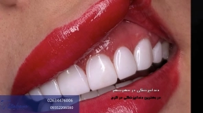 دندانپزشکی در مهرشهر کرج