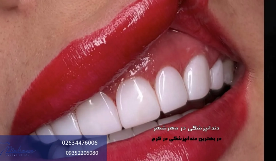 دندانپزشکی در مهرشهر کرج