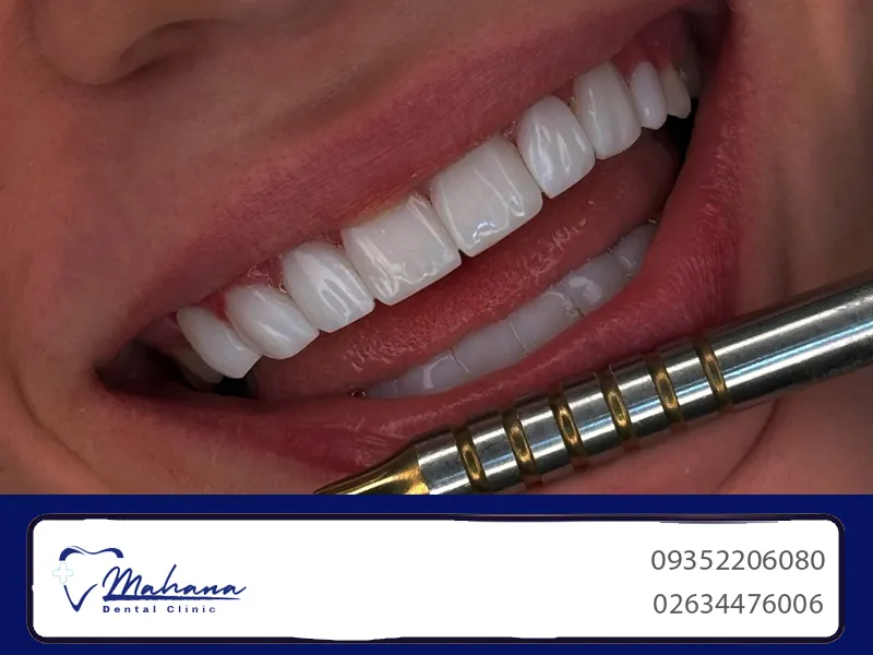 دندانپزشکی در عظیمیه کرج