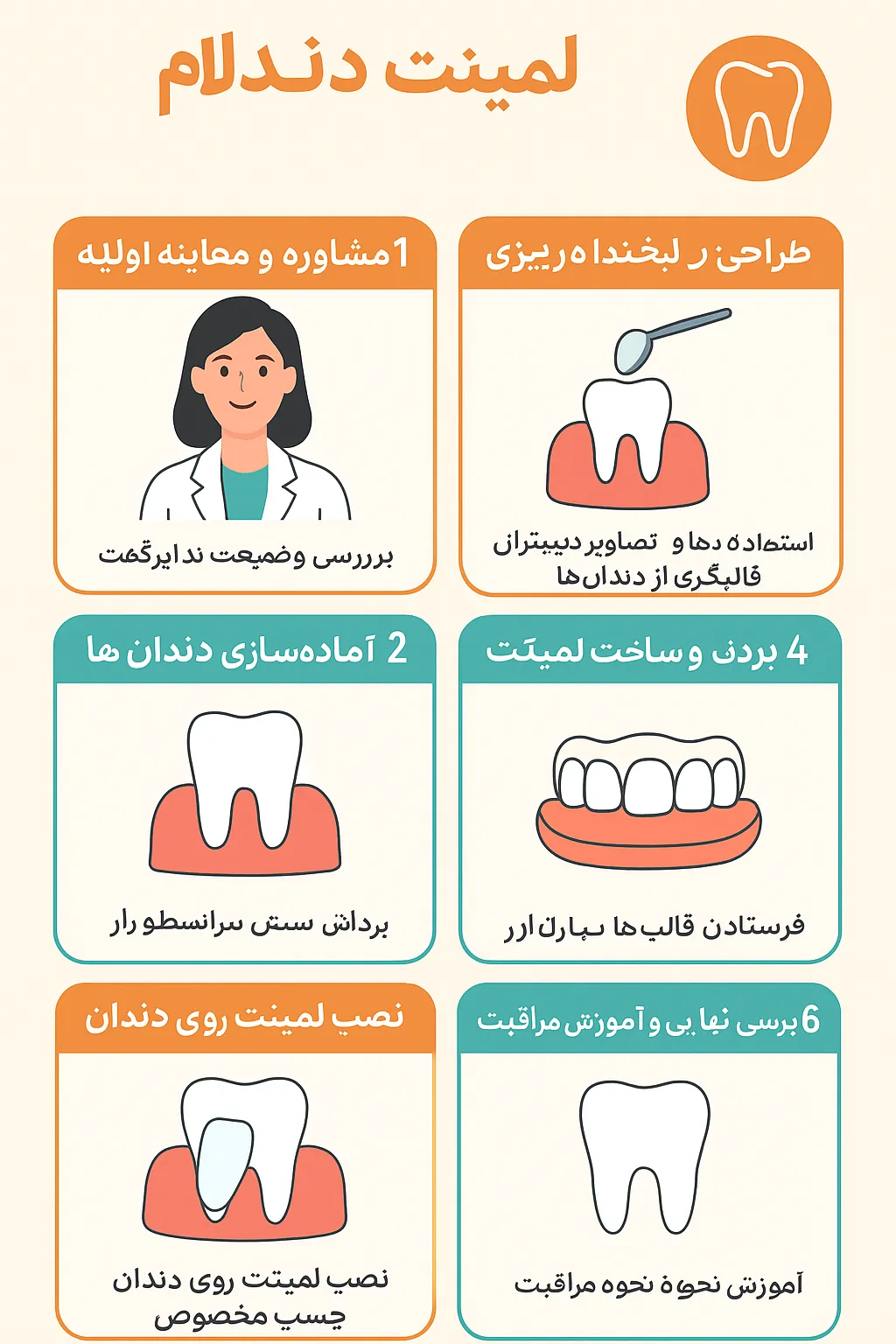 مراحل انجام لمینت
