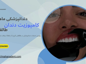 کامپوزیت دندان در طالقانی