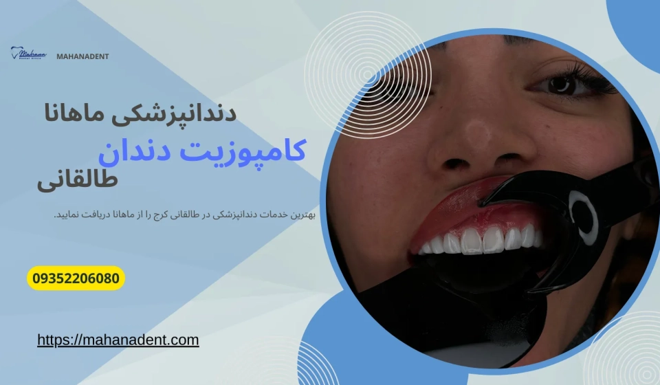 کامپوزیت دندان در طالقانی