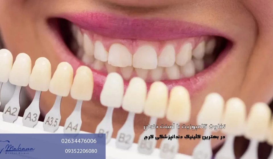 تفاوت لمینت با کامپوزیت