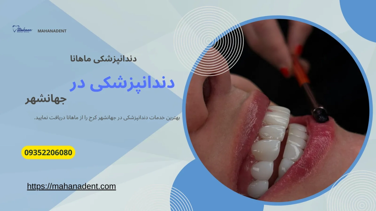 دندانپزشکی در جهانشهر کرج