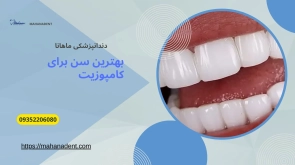 بهترین سن برای انجام کامپوزیت دندان