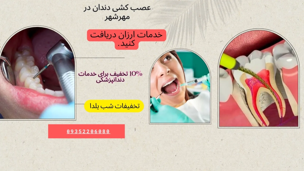 عصب کشی دندان در مهرشهر کرج