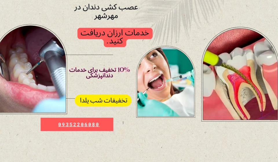 عصب کشی دندان در مهرشهر کرج