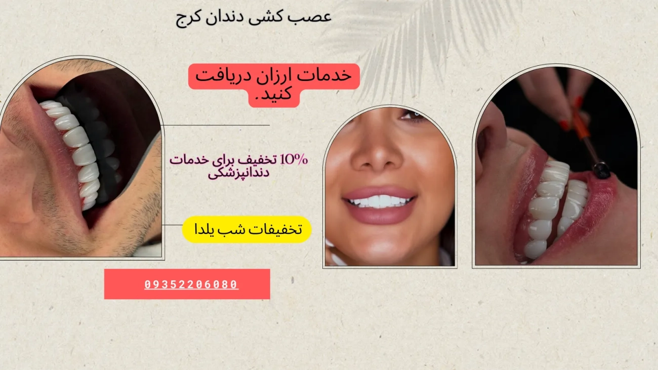 عصب کشی دندان در کرج