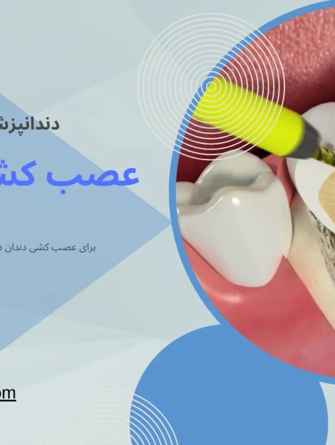 عصب کشی دندان در عظیمیه کرج