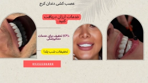 عصب کشی دندان در کرج