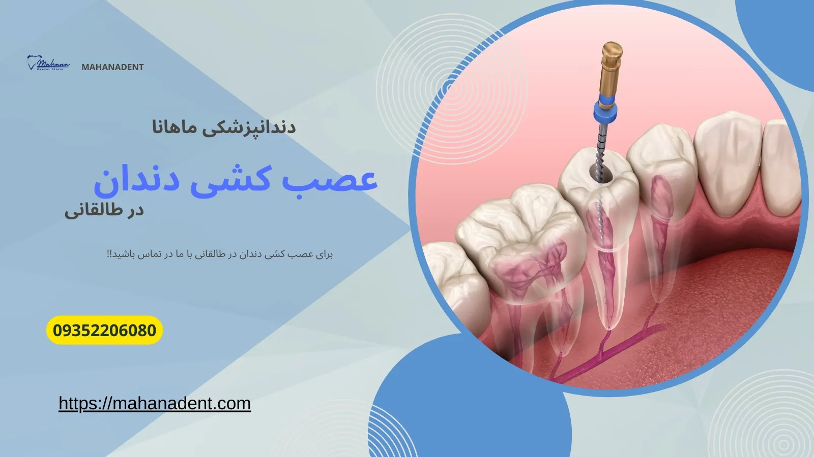 عصب کشی دندان در طالقانی کرج