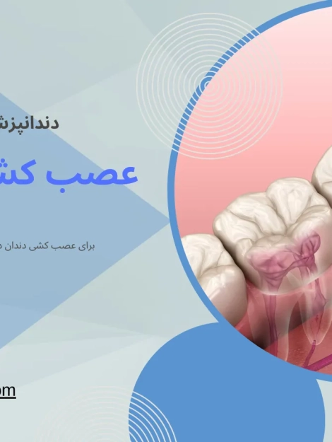 عصب کشی دندان در طالقانی کرج