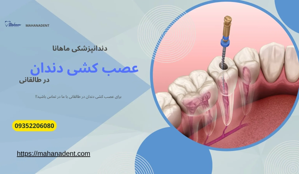 عصب کشی دندان در طالقانی کرج