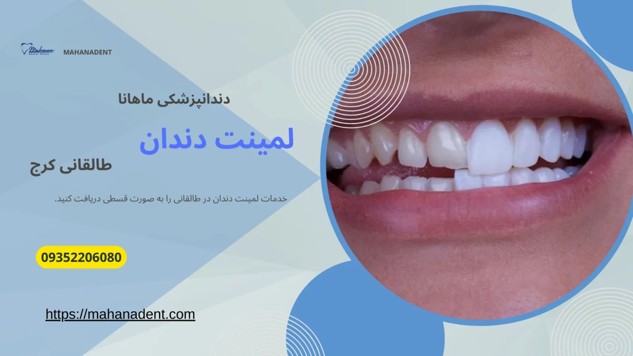 لمیت دندان در طالقانی کرج