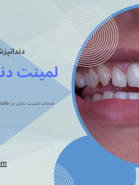 لمیت دندان در طالقانی کرج