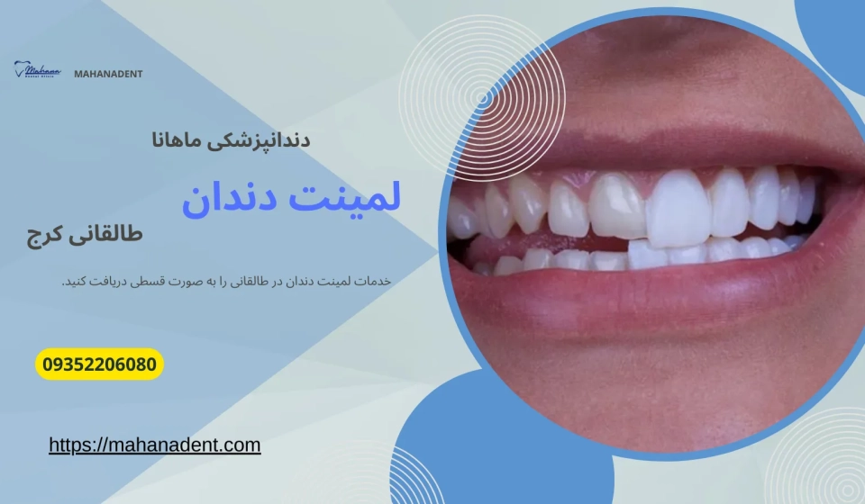 لمیت دندان در طالقانی کرج
