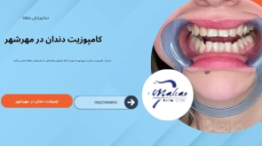 کامپوزیت دندان در مهرشهر