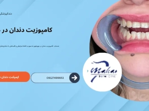کامپوزیت دندان در مهرشهر