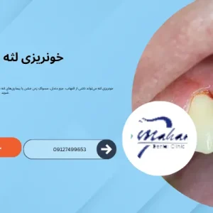 دلیل خون ریزی لثه