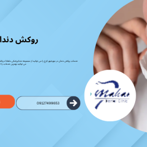 روکش دندان در مهرشهر کرج