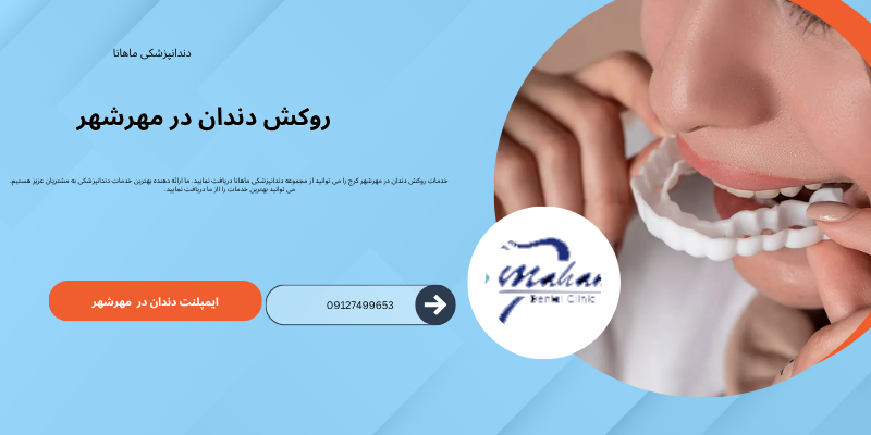 روکش دندان در مهرشهر کرج