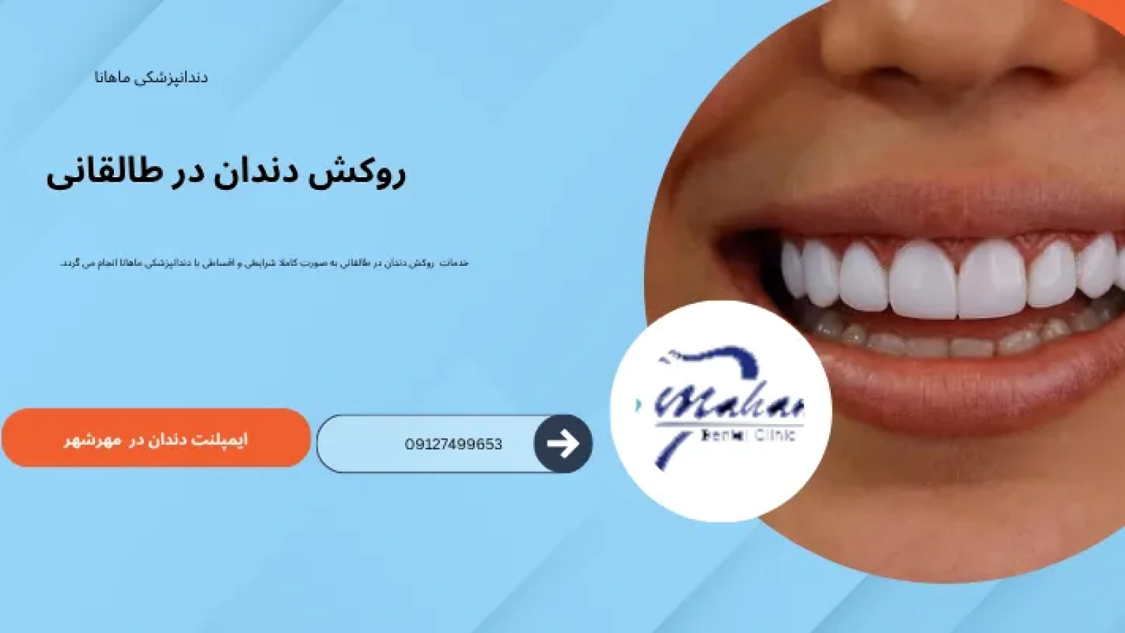 روکش دندان در طالقانی کرج