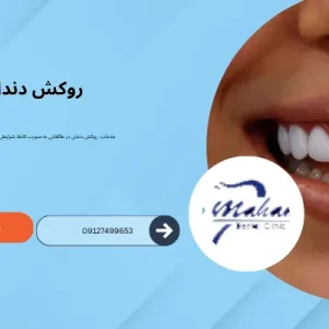 روکش دندان در طالقانی کرج