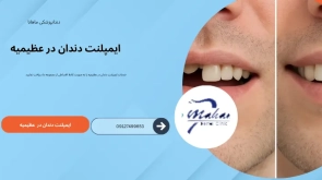 ایمپلنت دندان در عظیمیه کرج