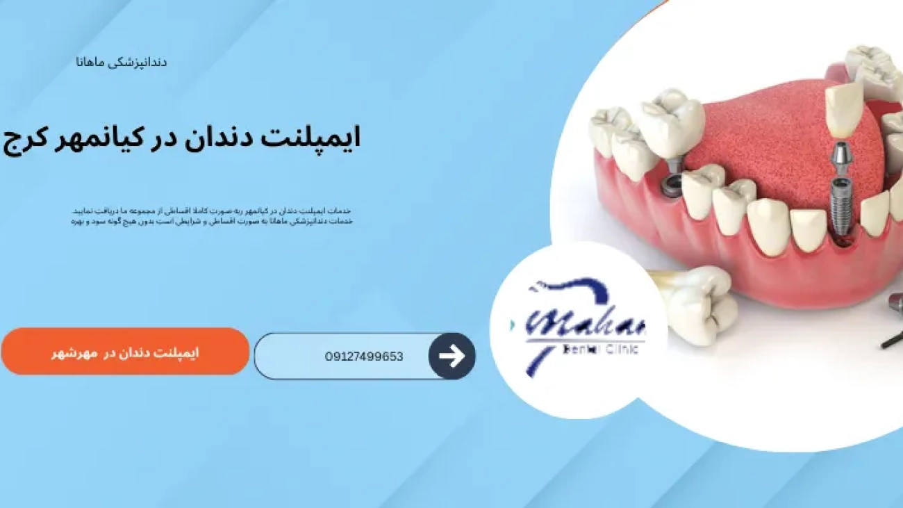 ایمپلنت دندان در کیانمهر کرج