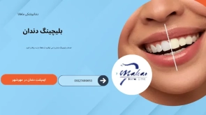 بلیچینگ دندان در کرج