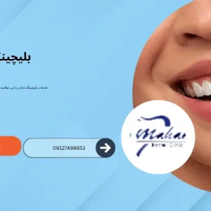 بلیچینگ دندان در کرج