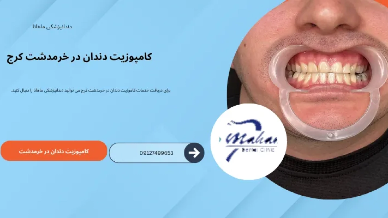 کامپوزیت دندان در خرمدشت کرج