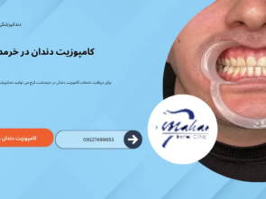 کامپوزیت دندان در خرمدشت کرج