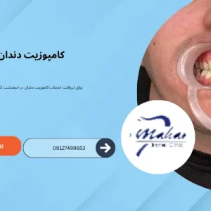 کامپوزیت دندان در خرمدشت کرج