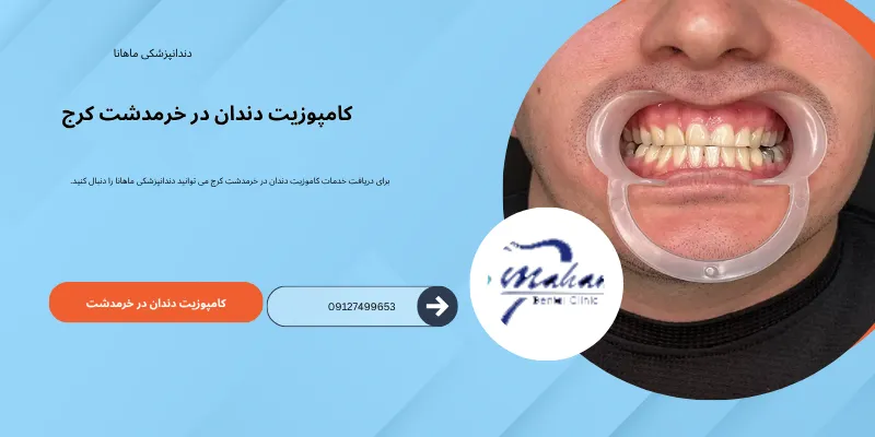 کامپوزیت دندان در خرمدشت کرج